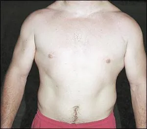 A quel joueur de Castelnau-en-Madiranais appartient ce torse ?