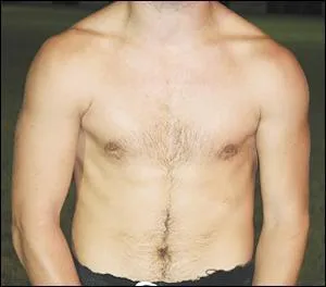 A quel joueur des Baronnies appartient ce torse ?