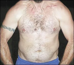 A quel joueur d'Ossun appartient ce torse ?