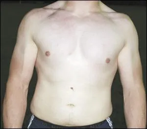 A quel joueur de Laloubre appartient ce torse ?