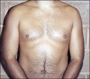 A quel joueur d'Aureilhan appartient ce torse ?