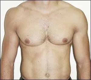 A quel joueur de Pouyastruc appartient ce torse ?