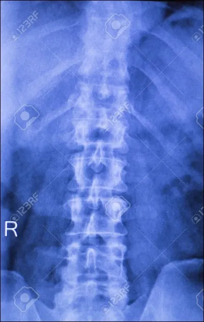 Sciences et nature : Quel animal vertébré possède le plus grand nombre de vertèbres cervicales ?
