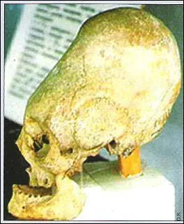 Comment appelle-t-on une personne ayant le crne plus long que large ?