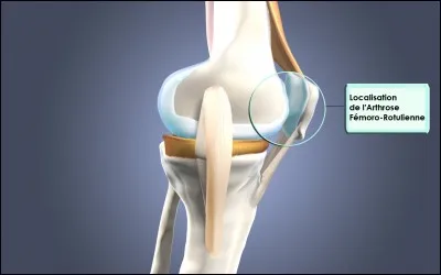 Comment s'appelle cet os ?