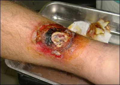 La scolopendre fait partie de la famille des arachnides !