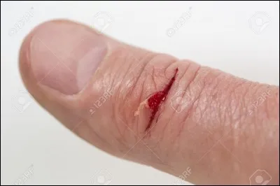 Tu as mal. Que fais-tu ?