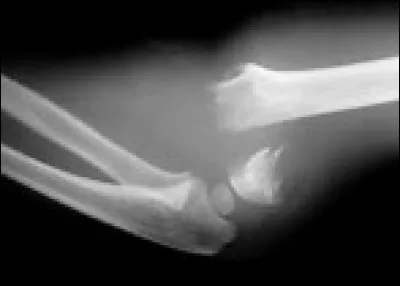 Regardez bien cette radiographie pour retrouvez le membre de la famille concerné par ce cliché.