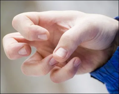 On la soigne avec des toxines botuliques. C'est un trouble neurologique qui se manifeste par des contractions musculaires involontaires.