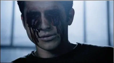 Pourquoi Scott doit-il enlever ses yeux pour combattre Anuk-Ite ?