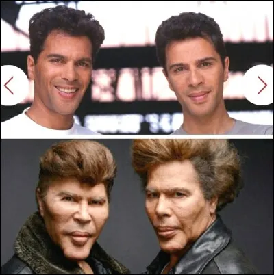 Régine est la détentrice du record du monde d'opérations chirurgicales. Combien en a-t-elle faites ?