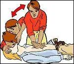 Combien y a-t-il de cycles dans un massage cardiaque ?