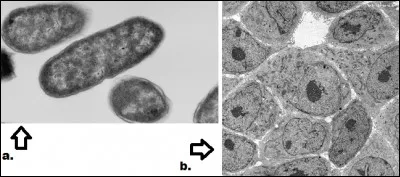Quelle image nous montre des cellules procaryotes ?