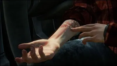 Qu'y a-t-il sur le bras droit de Ellie ?