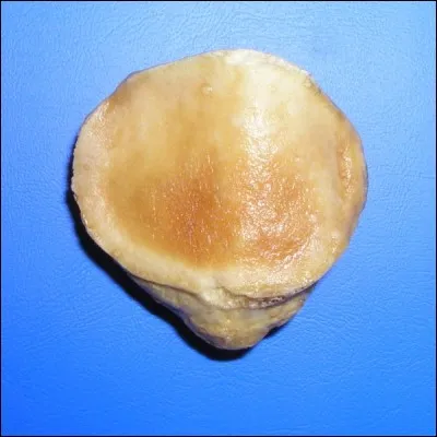 Et pour finir, quel nom ne porte pas cet os ?