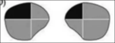 A quelle lésion correspond cette atteinte ?