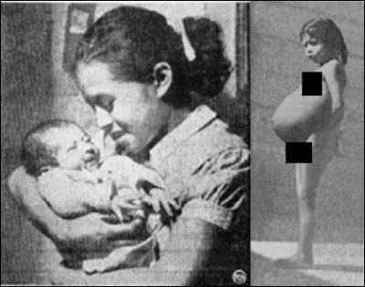 À quel âge Lina Médina est-elle devenue mère ?