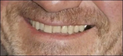 Cuisinier français, il a le titre de meilleur ouvrier de France. Qui est-ce ?