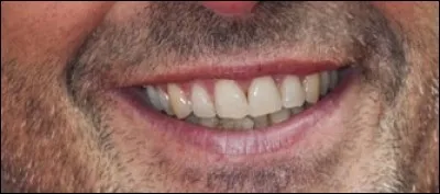 Quel présentateur français reconnaissez-vous à travers ce sourire ?