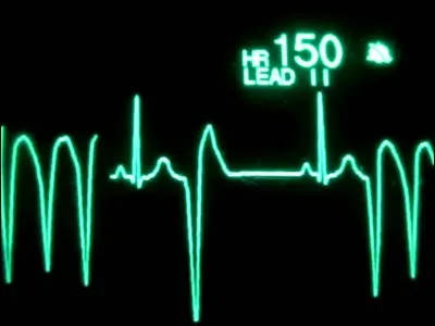 Quel joueur a failli perdre la vie sur le terrain ?