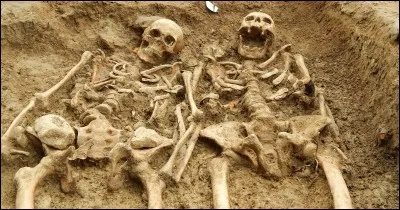 /Jambe/ Quel os du corps humain ne se situe pas dans la jambe ?