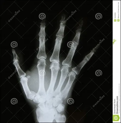 Les rayons X utilis&eacute;s en imagerie m&eacute;dicale ont &eacute;t&eacute; invent&eacute;s en 1895 par...