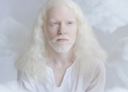 Quiz Quiz sur l'albinisme