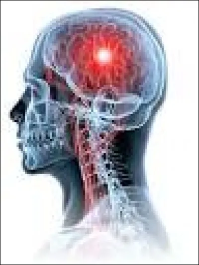 Si tu devais perdre quelque chose de ton corps, ce serait...