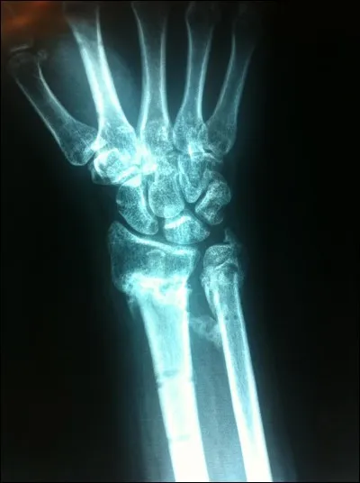 Quelle branche de la médecine traite des troubles des os, des articulations et des muscles ?