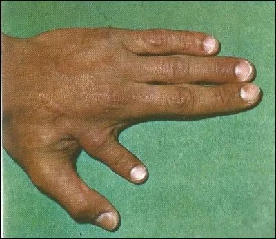 Quel nom porte l'étude des monstruosités chez les êtres vivants ?