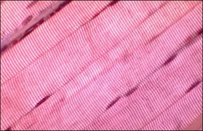 Une fibre musculaire striée est une fibre composée de :