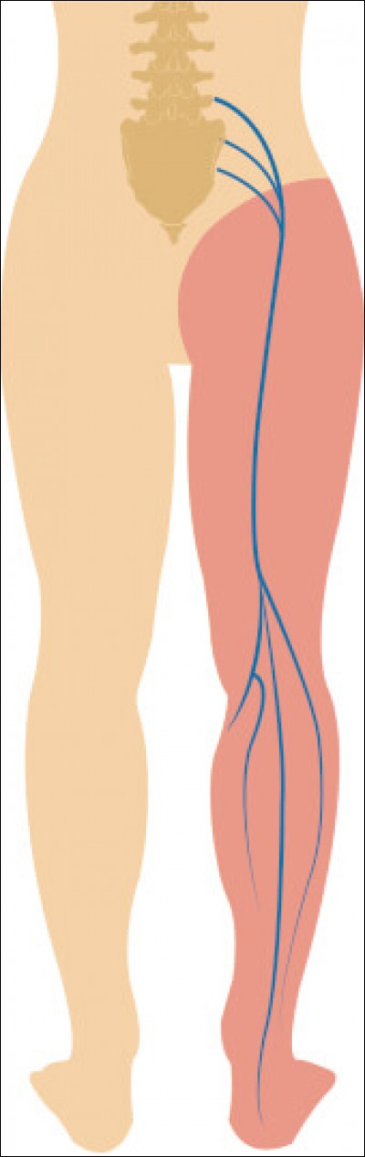 Quel est le nerf partant de la colonne, passant dans la cuisse et arrivant près du pied ?