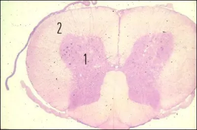 La moelle épinière est composée de 2 parties bien distinctes, lesquelles ?