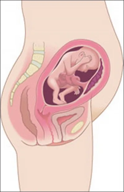 Dans quel ordre se déroulent normalement les étapes suivantes ?