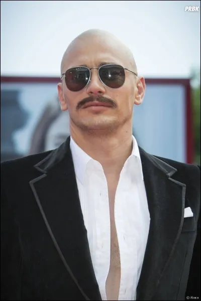 Aimes-tu les chauves ?