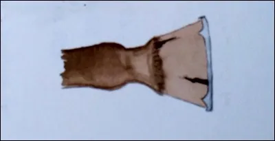 Comment appelle-t-on cette blessure ?