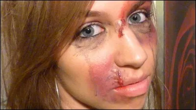 Un 'bleu' est également appelé...