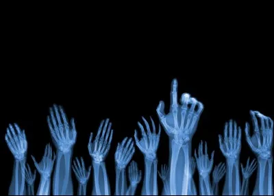 De quelle couleur le rayon est-il ?