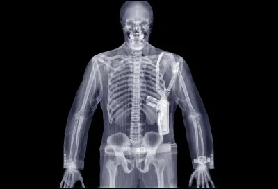 Qui a découvert les rayons X par hasard ?