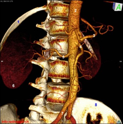 Que désigne le numéro 7 sur le même angioscanner ?
