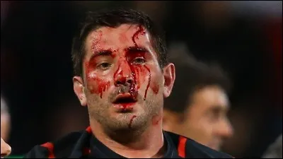 As-tu peur de te blesser ?