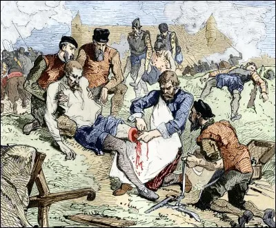 Quel "petit" barbier français a révolutionné la pratique de la chirurgie au XVIe siècle ?