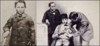 Comment s'appelait le premier enfant traité par Louis Pasteur contre la rage (avec succès) ?