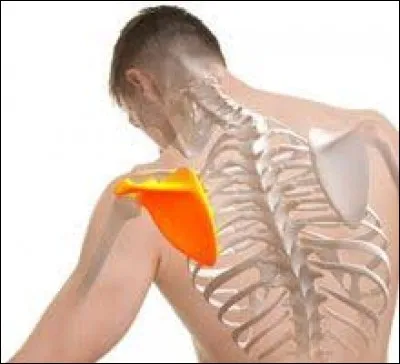 Quelle est la bonne orthographe de ce mot ?