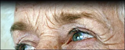 Les rides sont principalement caus&eacute;es par la d&eacute;gradation des fibres de collag&egrave;ne et d'&eacute;lastine (matrice extracellulaire).