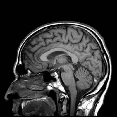 Le cerveau possède 2 hémisphères. L'hémisphère droit gère le côté gauche du corps et à l'inverse, l'hémisphère gauche contrôle le côté droit du corps.