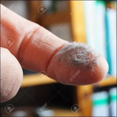 Que doit représenter cette image si elle se pose sur un pelage ?