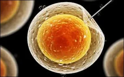 La FIVETE est une méthode de contraception :