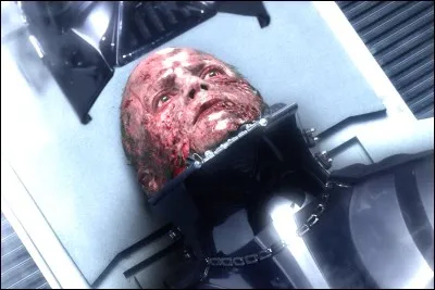 A cause de quel personnage, Anakin Skywalker est-il devenu moitié humain moitié cyborg ?