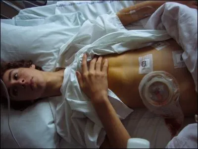 L'appendicite est un organe.